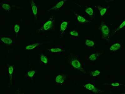 Immunocytochemistry/Immunofluorescence: FAT10 Antibody [NBP2-99524] - Immunofluorescence staining of FAT10 in HeLa cells. Cells were fixed with 4% PFA, permeabilzed with 0.1% Triton X-100 in PBS, blocked with 10% serum, and incubated with rabbit anti-human FAT10 polyclonal antibody (dilution ratio 1:1000) at 4C overnight. Then cells were stained with the Alexa Fluor(R)488-conjugated Goat Anti-rabbit IgG secondary antibody (green). Positive staining was localized to Nucleus .