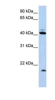 Western Blot: FAT10 Antibody [NBP1-58337] - Titration: 0.2-1 ug/ml, Positive Control: HepG2 cell lysate.