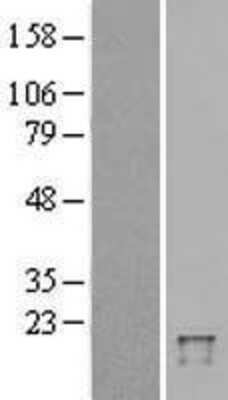 Western Blot: FAT10 Overexpression Lysate (Adult Normal) [NBL1-17510] Left-Empty vector transfected control cell lysate (HEK293 cell lysate); Right -Over-expression Lysate for FAT10.