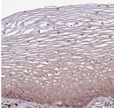 Immunohistochemistry-Paraffin: FAT4 Antibody [NBP2-49064] - Staining of human cervix, uterine shows weak to moderate cytoplasmic positivity in squamous epithelial cells.