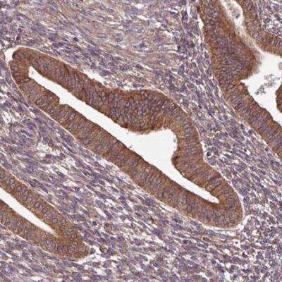 Immunohistochemistry-Paraffin: FAT4 Antibody [NBP2-49064] - Staining of human endometrium shows strong cytoplasmic positivity in glandular cells.