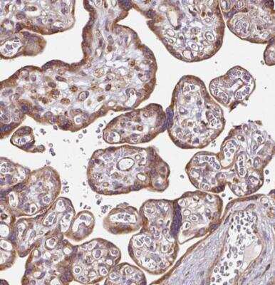 Immunohistochemistry-Paraffin: FAT4 Antibody [NBP2-49064] - Staining of human placenta shows moderate to strong cytoplasmic positivity in trophoblastic cells.