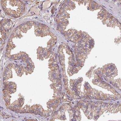 Immunohistochemistry-Paraffin: FAT4 Antibody [NBP2-49064] - Staining of human prostate shows weak to moderate membranous positivity in glandular cells.