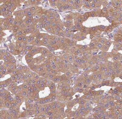 Immunohistochemistry-Paraffin: FAT4 Antibody [NBP2-49064] - Staining of human parathyroid gland shows moderate positivity in glandular cells.