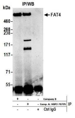 Immunoprecipitation: FAT4 Antibody [NBP2-78795] - Samples: Whole cell lysate (1.0 mg per IP reaction; 20% of IP loaded) from HeLa cells prepared using NETN lysis buffer. Antibodies: Affinity purified rabbit anti-FAT4 antibody NBP2-78795 used for IP at 15 ul per reaction. FAT4 was also immunoprecipitated by rabbit anti-FAT4 antibody from Company B. For blotting immunoprecipitated FAT4, NBP2-78795 was used at 1:1000. Detection: Chemiluminescence with an exposure time of 75 seconds.