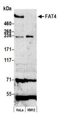 Western Blot: FAT4 Antibody [NBP2-78795] - Samples: Whole cell lysate (50 ug) from HeLa and KM12 cells prepared using NETN lysis buffer. Antibody: Affinity purified rabbit anti-FAT4 antibody NBP2-78795 used for WB at 1:1000. Detection: Chemiluminescence with an exposure time of 75 seconds.