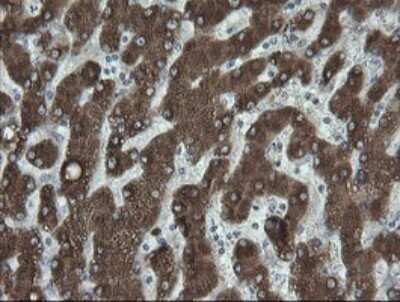 Immunohistochemistry: FATE1 Antibody (OTI1A1) - Azide and BSA Free [NBP2-72310] - Analysis of Human liver tissue.