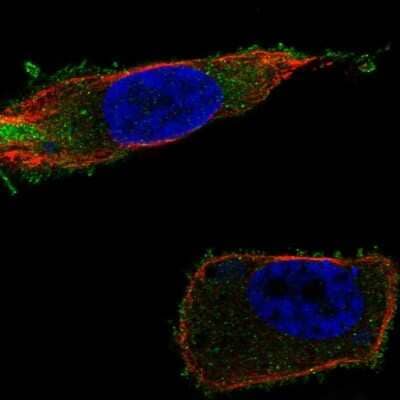 Immunocytochemistry/Immunofluorescence: FATP1/SLC27A1 Antibody [NBP2-69016] - Staining of human cell line PC-3 shows localization to plasma membrane. Antibody staining is shown in green.