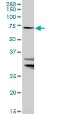 Western Blot: FATP1/SLC27A1 Antibody [H00376497-D01P] - Analysis of SLC27A1 expression in mouse lung.