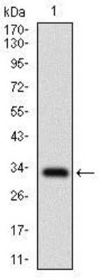 Western Blot: FATP2/SLC27A2 Antibody (6B3A9) [NBP2-37738] - Analysis using SLC27A2 mAb against human SLC27A2 recombinant protein. (Expected MW is 32.4 kDa).