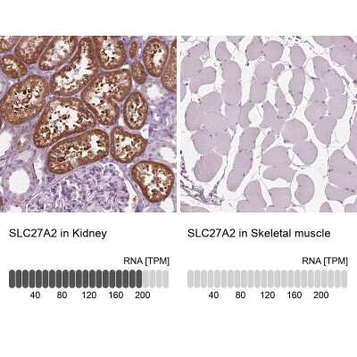 Immunohistochemistry-Paraffin: FATP2/SLC27A2 Antibody [NBP3-05516] - Analysis in human kidney and skeletal muscle tissues using NBP3-05516 antibody. Corresponding SLC27A2 RNA-seq data are presented for the same tissues.