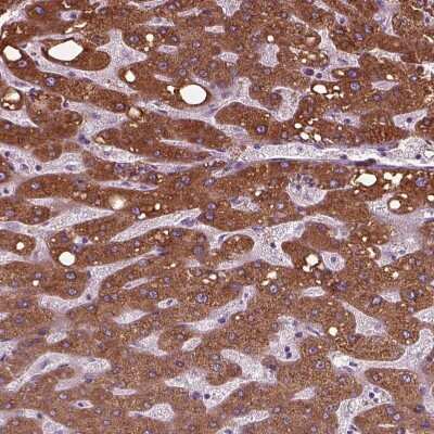 Immunohistochemistry-Paraffin: FATP2/SLC27A2 Antibody [NBP3-05516] - Staining of human Liver shows strong granular cytoplasmic positivity in hepatocytes.