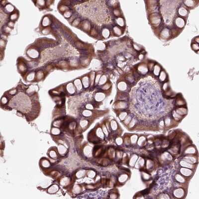 Immunohistochemistry-Paraffin: FATP2/SLC27A2 Antibody [NBP3-05516] - Staining of human Small intestine shows moderate granular cytoplasmic positivity in glandular cells.