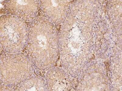 Immunohistochemistry-Paraffin: FATP3/SLC27A3 Antibody [NBP2-99424] - Immunochemical staining of mouse FATP3/SLC27A3 in mouse testis with rabbit polyclonal antibody at 1:1000 dilution, formalin-fixed paraffin embedded sections.