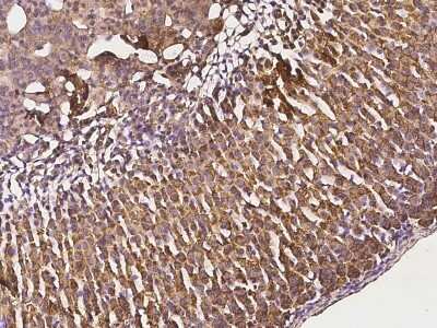 Immunohistochemistry-Paraffin: FATP3/SLC27A3 Antibody [NBP2-99424] - Immunochemical staining of mouse FATP3/SLC27A3 in mouse adrenal gland with rabbit polyclonal antibody at 1:1000 dilution, formalin-fixed paraffin embedded sections.