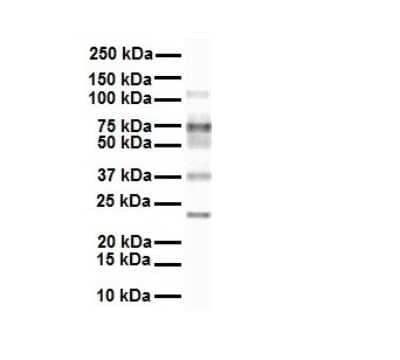 Western Blot: FATP3/SLC27A3 Antibody [NBP1-59839] - Antibody  Titration: 1 ug/ml Human MCF7.