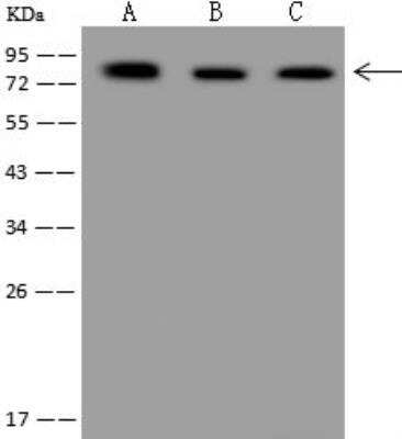 Western Blot: FATP3/SLC27A3 Antibody [NBP3-12706] - Lane A: MCF-7 Whole Cell LysateLane B: HEK-293 Whole Cell LysateLane C: RT-4 Whole Cell LysateLysates/proteins at 30 ug per lane.SecondaryGoat Anti-Rabbit IgG (H+L)/HRP at 1/10000 dilution.Developed using the ECL technique.Performed under reducing conditions.Predicted band size:79 kDaObserved band size:79 kDa