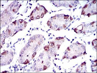 Immunohistochemistry: FATP5/SLC27A5 Antibody (4B11C10) [NBP2-37413] - Immunohistochemical analysis of paraffin-embedded stomach tissues using SLC27A5 mouse mAb with DAB staining.