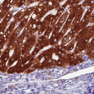 Immunohistochemistry-Paraffin: FATP5/SLC27A5 Antibody (CL0213) [NBP2-14788] - Staining of human liver shows strong cytoplasmatic positivity in hepatocytes.