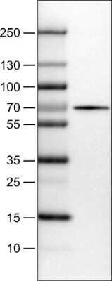 Western Blot: FATP5/SLC27A5 Antibody (CL0213) [NBP2-14788] - Lane 1: Marker [kDa], Lane 2: Human liver tissue lysate