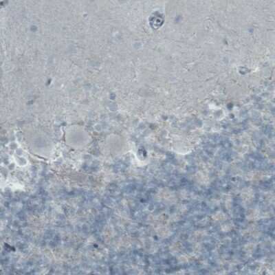 Immunohistochemistry-Paraffin: FATP5/SLC27A5 Antibody (CL0215) [NBP2-52880] - Staining of human cerebellum shows absence of staining in neuronal cells (negative control).