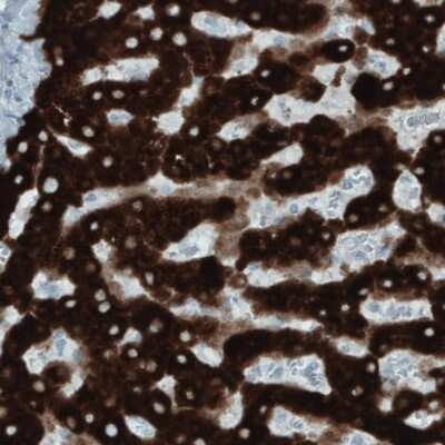 Immunohistochemistry-Paraffin: FATP5/SLC27A5 Antibody (CL0215) [NBP2-52880] - Staining of human liver shows strong immunoreactivity in hepatocytes.