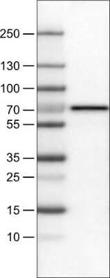 Western Blot: FATP5/SLC27A5 Antibody (CL0215) [NBP2-52880] - Lane 1: Marker [kDa], Lane 2: Human liver tissue lysate