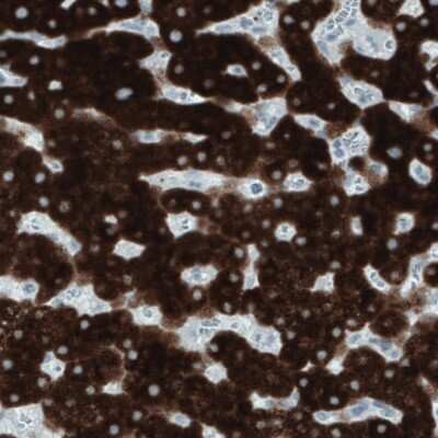 Immunohistochemistry-Paraffin: FATP5/SLC27A5 Antibody (CL0216) [NBP2-52881] - Staining of human liver shows strong immunoreactivity in hepatocytes.