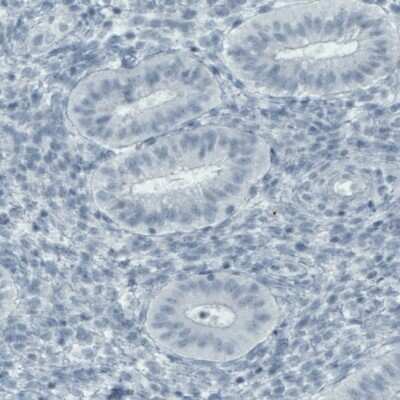 Immunohistochemistry-Paraffin: FATP5/SLC27A5 Antibody (CL0216) [NBP2-52881] - Staining of human uterus shows absence of staining (negative control).