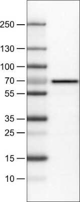 Western Blot: FATP5/SLC27A5 Antibody (CL0216) [NBP2-52881] - Lane 1: Marker [kDa], Lane 2: Human liver tissue lysate