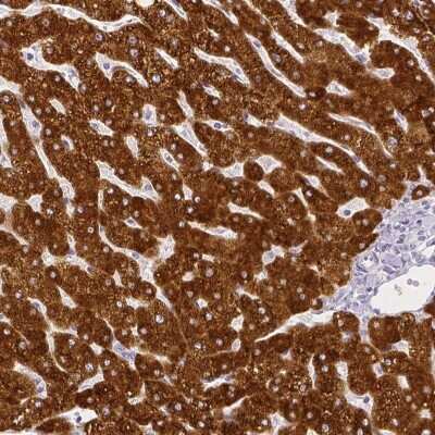 Immunohistochemistry-Paraffin: FATP5/SLC27A5 Antibody [NBP1-89267] - Staining of human liver shows high expression.