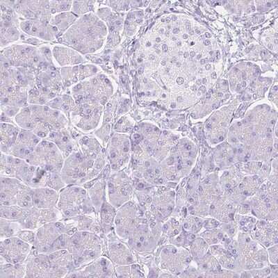 Immunohistochemistry-Paraffin: FATP5/SLC27A5 Antibody [NBP1-89267] - Staining of human pancreas shows low expression as expected.