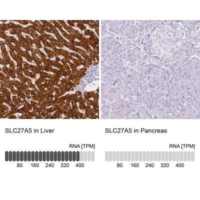 Immunohistochemistry-Paraffin: FATP5/SLC27A5 Antibody [NBP1-89267] - Staining in human liver and pancreas tissues using anti-SLC27A5 antibody. Corresponding SLC27A5 RNA-seq data are presented for the same tissues.