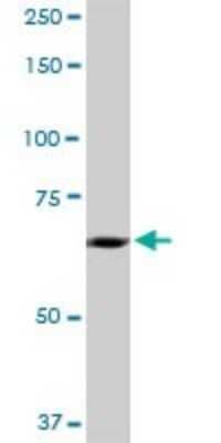 Western Blot: FATP5/SLC27A5 Antibody [H00010998-B01P] - Analysis of SLC27A5 expression in human liver.