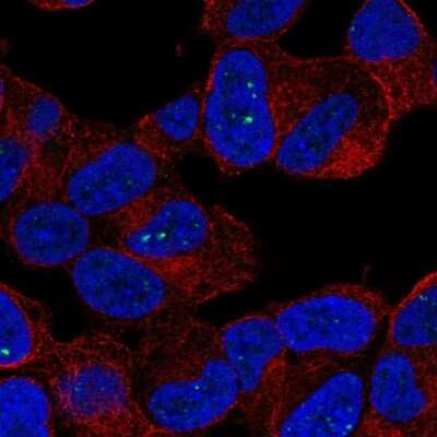 Immunocytochemistry/Immunofluorescence: FATP6/SLC27A6 Antibody [NBP3-05511] - Staining of human cell line SH-SY5Y shows localization to nuclear bodies.