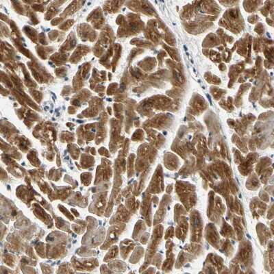 Immunohistochemistry-Paraffin: FATP6/SLC27A6 Antibody [NBP3-05511] - Staining of human heart muscle shows strong cytoplasmic positivity in myocytes.