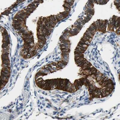 Immunohistochemistry-Paraffin: FATP6/SLC27A6 Antibody [NBP3-05511] - Staining of human Fallopian tube shows strong membranous positivity in glandular cells.