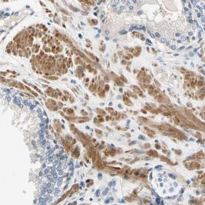 Immunohistochemistry-Paraffin: FATP6/SLC27A6 Antibody [NBP3-05511] - Staining of human prostate shows moderate cytoplasmic positivity in smooth muscle cells.