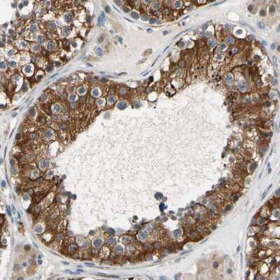 Immunohistochemistry-Paraffin: FATP6/SLC27A6 Antibody [NBP3-05511] - Staining of human testis shows strong membranous positivity in cells in seminiferous ducts.