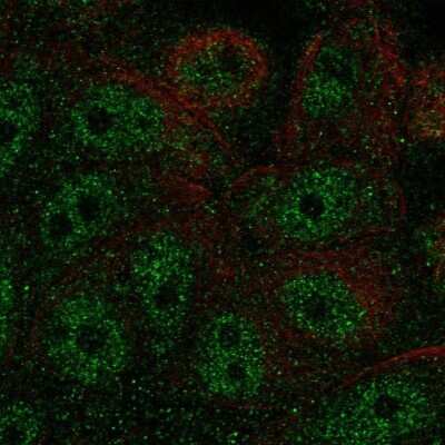 Immunocytochemistry/Immunofluorescence: FBP2 Antibody [NBP2-58520] - Staining of human cell line MCF7 shows localization to nucleoplasm.