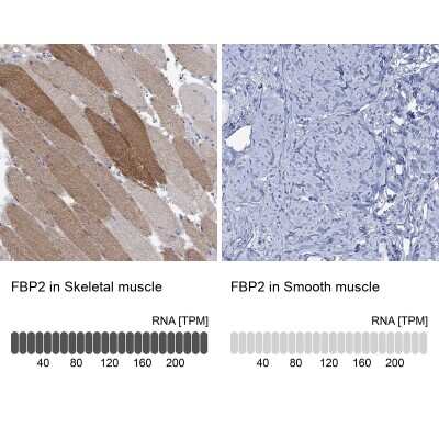 Immunohistochemistry-Paraffin FBP2 Antibody - BSA Free