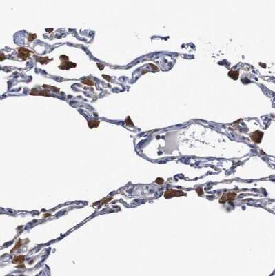 Immunohistochemistry-Paraffin FBP2 Antibody - BSA Free