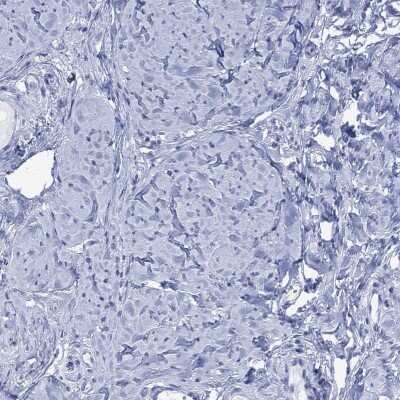 Immunohistochemistry-Paraffin: FBP2 Antibody [NBP3-17033] - Staining of human smooth muscle shows low expression as expected.