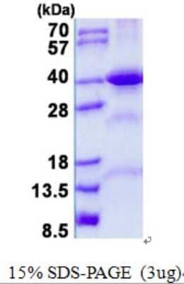 SDS-PAGE Recombinant Human FBP2 His Protein