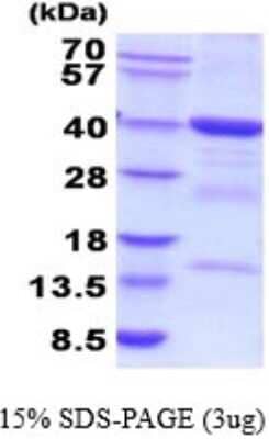 SDS-PAGE Recombinant Human FBP2 His Protein