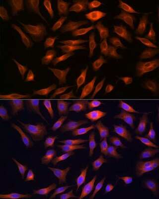Immunocytochemistry/Immunofluorescence: FBPase 1 Antibody (7N8C1) [NBP3-15423] - Immunofluorescence analysis of HeLa cells using FBPase 1 Rabbit mAb (NBP3-15423) at dilution of 1:100 (40x lens). Blue: DAPI for nuclear staining.