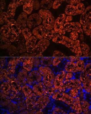 Immunohistochemistry: FBPase 1 Antibody (7N8C1) [NBP3-15423] - Immunofluorescence analysis of rat kidney using FBPase 1 Rabbit mAb (NBP3-15423) at dilution of 1:100 (40x lens). Blue: DAPI for nuclear staining.