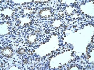 Immunohistochemistry: FBPase 1 Antibody [NBP1-55293] - Human alveolar cell Cellular data: Epithelial cells of renal tubule Antibody Concentration: 4.0-8.0 ug/ml Magnification: 400X.