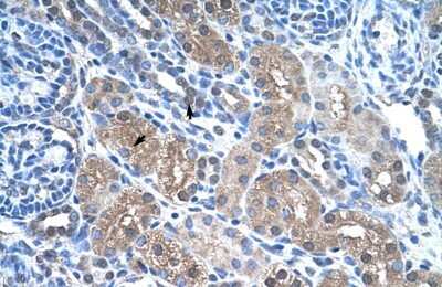 Immunohistochemistry-Paraffin: FBPase 1 Antibody [NBP1-55293] - Human kidney Tissue, antibody concentration 4-8ug/ml. Cells with positive label: renal corpuscle cells (indicated with arrows) 400X magnification.