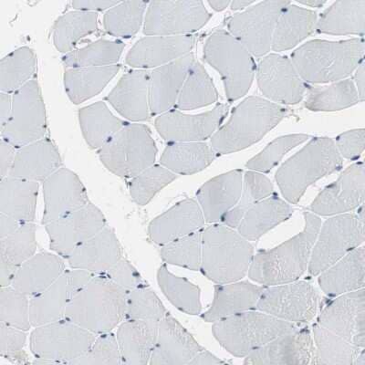 Immunohistochemistry-Paraffin: FBPase 1 Antibody [NBP1-84721] - Staining of human skeletal muscle shows no positivity in myocytes as expected.